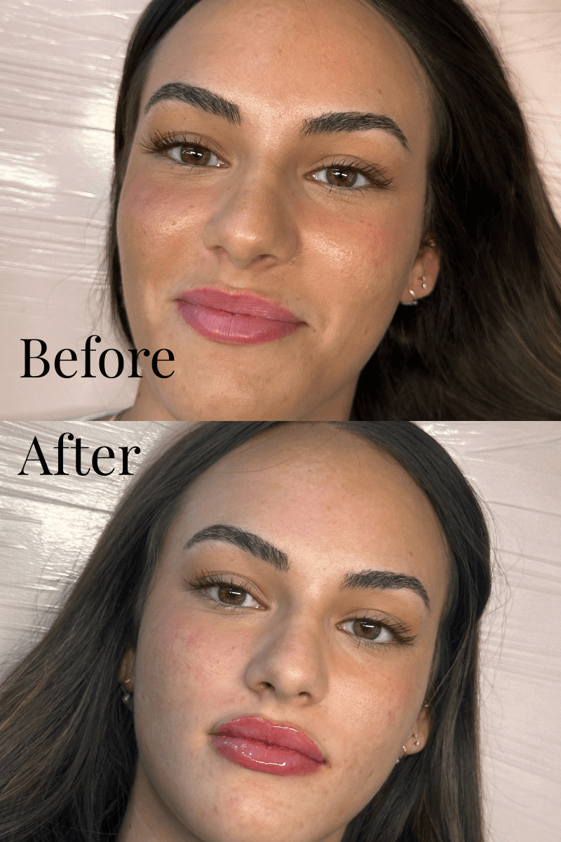 3 tattoo lip blush before and after